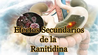 Efectos Secundarios de la Ranitidina [upl. by Russ947]