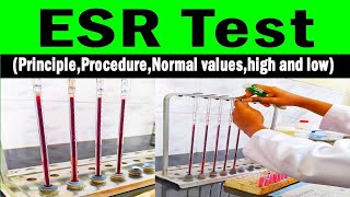 ESR Estimation by Westergren Method [upl. by Deadman]