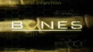 Bones  1x01  Pilot Promo [upl. by Enomes]