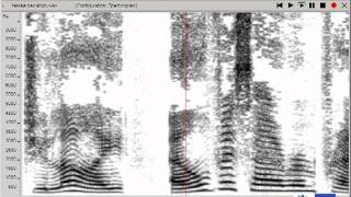 Real time spectrographic display healthy female voice [upl. by Fritz]