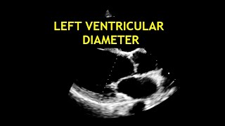 How to measure the LEFT VENTRICULAR DIAMETER Echocardiography [upl. by Nomead]