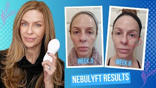 Skin Tightening Results  What I Learned Using Nebulyft R2 3X Per Week vs Daily Use [upl. by Asiram]