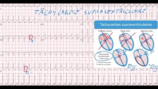 20 ECG  Quiz  Dr Synapse [upl. by Lrae]