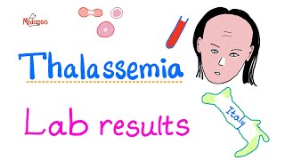 Thalassemia  Lab Results  How To Diagnose Thalassemia  Hematology Series [upl. by Kerwin44]