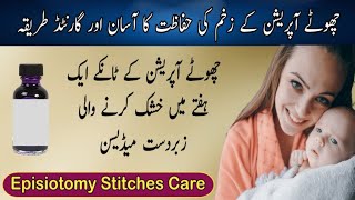 Chota Operation Recovery In Urdu  सामान्य प्रसव के टांके की घर पर देखभाल  Episiotomy Stitches Care [upl. by Croteau]