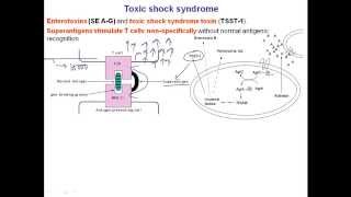 Toxic shock syndrome [upl. by Adlig918]