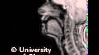 MRI voiced alveolar trill [upl. by Elvin]