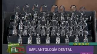 Especialista se refirió a la implantología dental [upl. by Naraj]