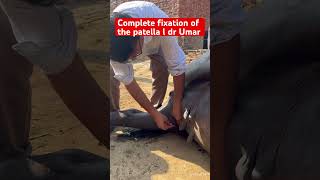 Complete fixation of the patella l dr Umar khan [upl. by Gothar795]