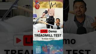 Live Treadmill Test heart treadmill hearthealth shorts short shortvideos drkrishvaidya [upl. by Oel]