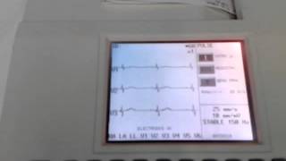 ELECTROCARDIÓGRAFO BURDICK MODELO ECLIPSE 850 [upl. by Thurber]