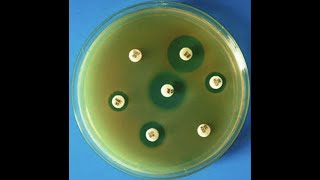 Antibiotic sensitivity test [upl. by Adnulahs]