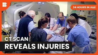 CT Scans That Change Lives  24 Hours in AampE  Medical Documentary [upl. by Desberg65]