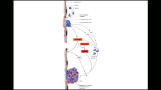 Fluid amp Haemodynamic derangements 2 [upl. by Adiela654]