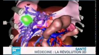 La semaine prochaine  Médecine  La révolution 3D [upl. by Giuliana]