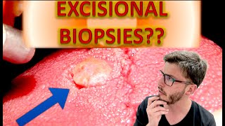 Excisional BIOPSY TUTORIAL Step by Step ORAL MEDICINE DENTISTRY for lesions  Dental Surgery [upl. by Carmelo21]