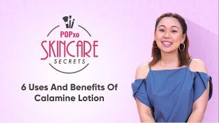 6 Uses And Benefits Of Calamine Lotion  POPxo Skincare Secrets [upl. by Ultima176]