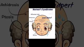 Horner syndrome mbbs usmle anatomy neuroscience biology studymotivation anatomy viralvideo [upl. by Aloiv]