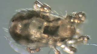 Parasitic bird mites alive under optical microscope 14 [upl. by Alissa]