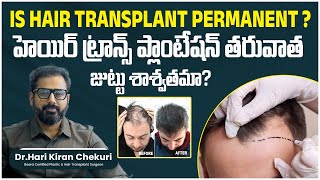 Is Hair Transplant Permanent in Telugu  Best Hair Transplant Surgeon in Hyderabad  ReDefine [upl. by Dav]