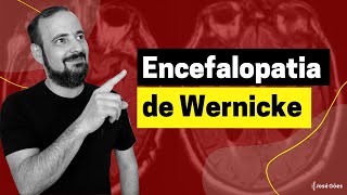 Encefalopatia de Wernicke  José Góes [upl. by Eikcaj]