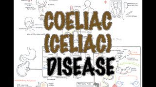 Coeliac Celiac Disease  Overview signs and symptoms pathophysiology diagnosis treatment [upl. by Seafowl]