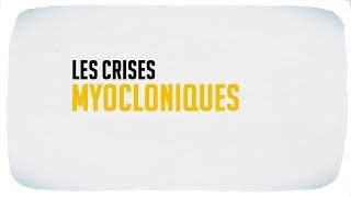 Les crises myocloniques [upl. by Nirahs968]