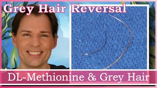 GREY HAIR REVERSAL CATALASE HELP AND DLMETHIONINE  HYDROGEN PEROXIDE  ANTIOXIDANTS  STOP GREYS [upl. by Anitnatsnok]