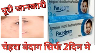 Hydroquinone Tretinoin amp Mometasone Furoate Cream Review by Guru Kirpa Clinic [upl. by Atikel]