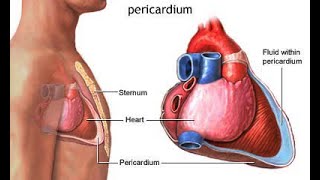 Cardiac Tamponade [upl. by Rainie]