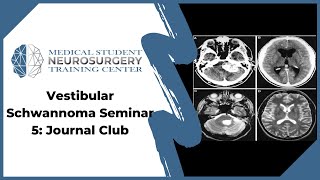 Vestibular Schwannoma Seminar 5 Journal Club [upl. by Wanids]