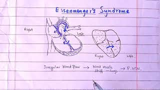 Eisenmenger syndrome  What will Happen If Blood Flows From Right to Left Heart [upl. by Kerrin846]