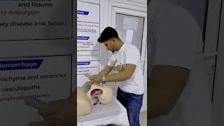 Endotracheal Intubation [upl. by Munshi]