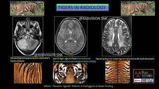 TIGERS IN RADIOLOGY [upl. by Iegres]