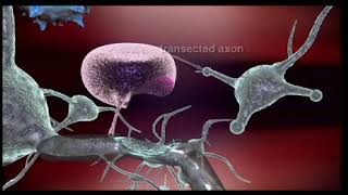 Mechanism of Action of Natalizumab a medication used to treat multiple sclerosis amp Crohns disease [upl. by Mayberry]