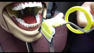 Posterior Periapical Mandibular Placement [upl. by Nahsez]