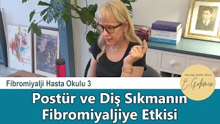 Postür ve Diş Sıkmanın Fibromiyaljiye Etkisi  Fibromiyalji Hasta Okulu 3 [upl. by Nealy557]