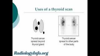 Your Radiologist Explains Thyroid Gland and Scan [upl. by Cirdla]