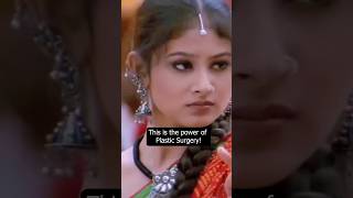 when Mouny Roy Got Trolled For Plastic Surgery shorts mounyroy [upl. by Ancilin986]