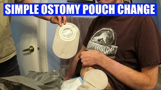 Changing a colostomy bag  quick and easy [upl. by Miltie974]