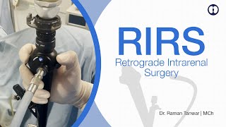 RIRS  Retrograde Intrarenal Surgery  Latest scarless Laser Kidney Stone Surgery [upl. by Ennazus822]