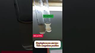 Tube coagulase test for Staphylococcus aureus staphylococcus tubecoagulase [upl. by Llerrat]