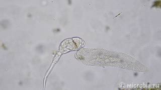 A ciliate devours a rotifer Зверский аппетит хищной инфузории [upl. by Anij]