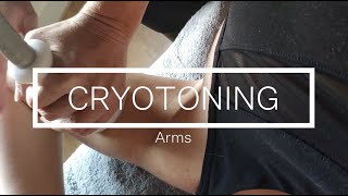 Cryoskin Révolution Tutorial Cryotoning arms session [upl. by Snahc686]