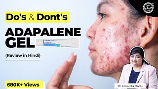 Adapalene Gel Review  Adapalene Gel 01  How to Use Adapalene Gel 01  Dr Nivedita Dadu [upl. by Ripp]