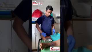 How To Do Dressing of Varicose Ulcer  Dr Ashank Bansal mumbai ulcertreatment [upl. by Dagley616]