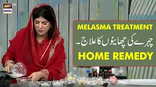 Melasma Remedy  Chehre ki Chaiyon ka Ilaaj GoodMorningPakistan [upl. by Still]