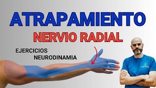 NERVIO RADIAL diagnóstico y tratamiento NEURODINAMIA [upl. by Amersham]