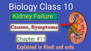 Kidney Failure Explained Causes Symptoms amp LifeSaving Tips Explained in Hindi and urdu [upl. by Rust]