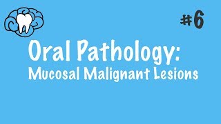 Oral Pathology  Mucosal Malignant Lesions  INBDE ADAT [upl. by Ardnuasal]